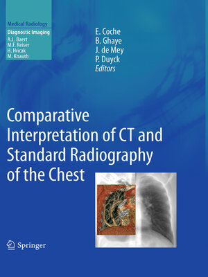 cover image of Comparative Interpretation of CT and Standard Radiography of the Chest